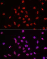POLR2A Antibody in Immunocytochemistry (ICC/IF)