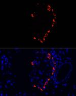 Glucagon Antibody in Immunocytochemistry (ICC/IF)