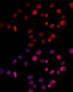 MSH2 Polyclonal Antibody