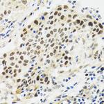 p53 Antibody in Immunohistochemistry (Paraffin) (IHC (P))