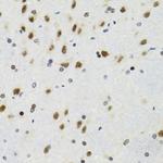 p53 Antibody in Immunohistochemistry (Paraffin) (IHC (P))