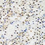 p53 Antibody in Immunohistochemistry (Paraffin) (IHC (P))