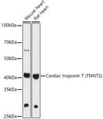 Cardiac Troponin T Polyclonal Antibody