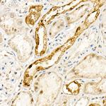NOX4 Polyclonal Antibody