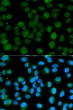 Emerin Antibody in Immunocytochemistry (ICC/IF)