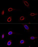 Emerin Polyclonal Antibody