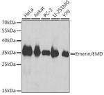 Emerin Antibody in Western Blot (WB)