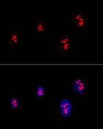Fibrillarin Antibody in Immunocytochemistry (ICC/IF)