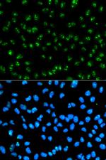 Fibrillarin Antibody in Immunocytochemistry (ICC/IF)