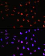 TCF4 Antibody in Immunocytochemistry (ICC/IF)