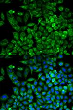 Aldolase A Polyclonal Antibody