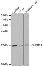 SAP (SLAM-Associated Protein) Polyclonal Antibody