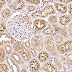 PYCARD Antibody in Immunohistochemistry (Paraffin) (IHC (P))