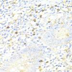 SQSTM1 Antibody in Immunohistochemistry (Paraffin) (IHC (P))