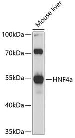 HNF4A Polyclonal Antibody