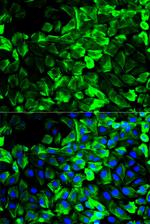 TPM1 Polyclonal Antibody