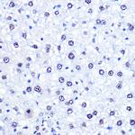 CHD4 Antibody in Immunohistochemistry (Paraffin) (IHC (P))
