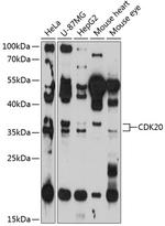 CDK20 Polyclonal Antibody