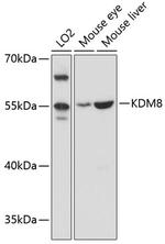 JMJD5 Polyclonal Antibody
