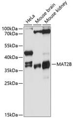 MAT2B Polyclonal Antibody