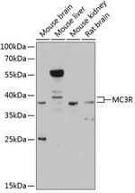 MC3R Polyclonal Antibody