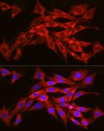 SEC61A1 Polyclonal Antibody