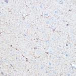 Aldolase C Antibody in Immunohistochemistry (Paraffin) (IHC (P))