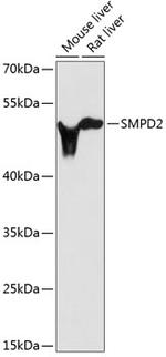 SMPD2 Polyclonal Antibody