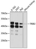 TRIB2 Polyclonal Antibody