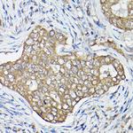 GTPBP9 Antibody in Immunohistochemistry (Paraffin) (IHC (P))