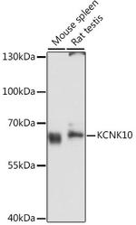 KCNK10 Antibody in Western Blot (WB)