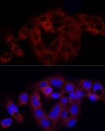 RPS18 Antibody in Immunocytochemistry (ICC/IF)