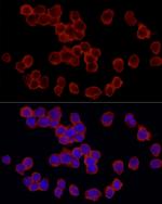 RPS18 Antibody in Immunocytochemistry (ICC/IF)
