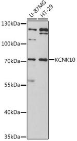 KCNK10 Polyclonal Antibody