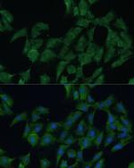 DDX3Y Antibody in Immunocytochemistry (ICC/IF)