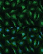 DDX3Y Polyclonal Antibody