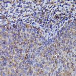 beta-Arrestin 2 Antibody in Immunohistochemistry (Paraffin) (IHC (P))