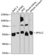 SPTLC2 Polyclonal Antibody