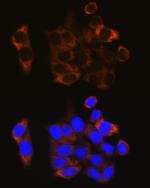 Calpain 1 Antibody in Immunocytochemistry (ICC/IF)