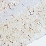Calpain 1 Antibody in Immunohistochemistry (Paraffin) (IHC (P))