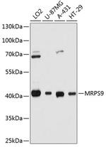 MRPS9 Polyclonal Antibody