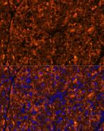 SERPINI2 Polyclonal Antibody