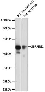 SERPINI2 Antibody in Western Blot (WB)