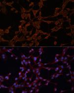 P-Glycoprotein Polyclonal Antibody