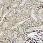 P-Glycoprotein Antibody in Immunohistochemistry (Paraffin) (IHC (P))