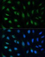 GADD45A Polyclonal Antibody