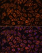TLR3 Polyclonal Antibody