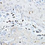 NCF2 Polyclonal Antibody