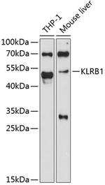 KLRB1 Polyclonal Antibody