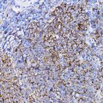 TGFBR2 Polyclonal Antibody